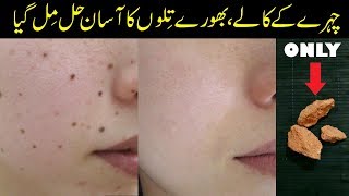 Remove Moles from FACE with this Simple Home Remedy Urdu Hindi [upl. by Hassett442]