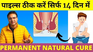 Piles Treatment पुराने से पुराना पाइल्स बवासीर 14 दिन में जड़ से ठीक करें  Piles Home Treatment [upl. by Assenahs]