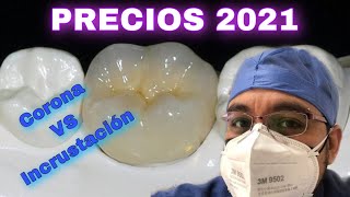 CORONA vs INCRUSTACION  ¿Cuanto cuestan en 2021 [upl. by Nodababus67]