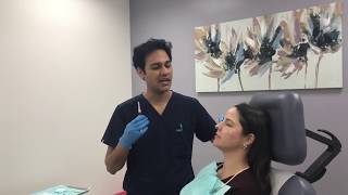 Cheek filler treatment using Restylane Lyft by Dr Shaun Patel [upl. by Anikahs]