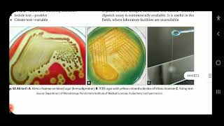 Apurba S Sastry Microbiology Cholera Halophilic vibrio amp aeromonas infections part 2 [upl. by Balas]