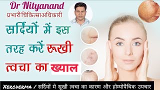 xeroderma  xerosis  dry skin causes symptoms prevention and homoeopathic treatmentdrnityanand [upl. by Afrikah906]