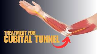 Can You Beat Cubital Tunnel Syndrome Discover Proven Treatment Tipsquot [upl. by Drofnats]