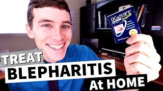 What is Blepharitis How to Treat Blepharitis at Home [upl. by Leakcim]