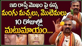 మంగు మచ్చలను పోగొట్టే సింపుల్ హోమ్ రెమెడీ mangu machalu povalante Pigmentation Dark Spots on Face [upl. by Lorenz7]