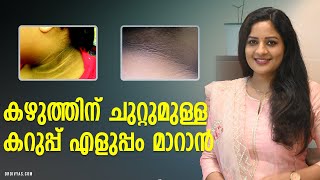 കഴുത്തിന് ചുറ്റുമുള്ള കറുപ്പ് എളുപ്പം മാറാൻ  HOW TO GET RID OF DARK NECK FAST amp NATURALLY [upl. by Ailahk540]