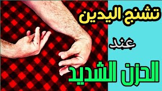 تشنج اليدين عند الصدمات النفسية، الزعل، و نوبات الهلعلا داعي لمراجعة الطوارئ carpopedal spasm [upl. by Femmine]