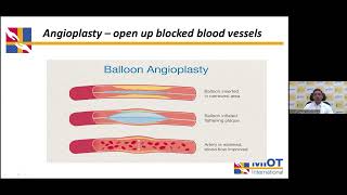 MIOT Hospital amp The Hindu Present Genicular Artery Embolization [upl. by Cutlip]