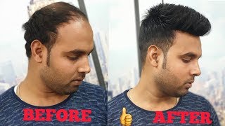 a non surgical hair clipping system wig for man in delhi amp agra by master RIZY [upl. by Inobe]