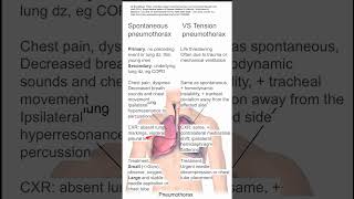 Spontaneous vs Tension Pneumothorax [upl. by Eikin]