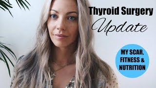 Thyroid Surgery Update  My scar fitness amp nutrition 1 year later [upl. by Aihsenak]