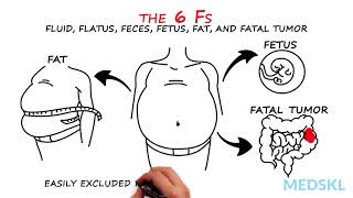 Abdominal Distension The 6 Fs that can help your diagnosis [upl. by Leilah]