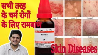 Sulphur Mother Tincture ko kaun kaun si skin disease चर्म रोग में use Karen aur kaise use Karen [upl. by Ennirak453]