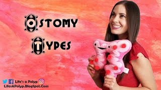 What are Ostomies [upl. by Adlez]