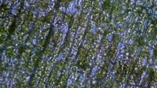 Plasmolysis in Elodea [upl. by Salahcin]