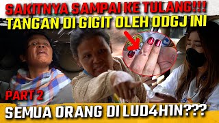 SEMUA PANIK MELEPASKAN GIGITAN ODGJ INI KE TANGAN TEH NOVI  PRATIWI NOVIYANTHI [upl. by Kola922]