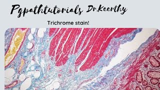 Masson trichrome stain [upl. by Campney]