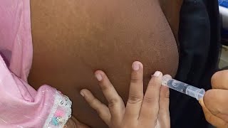 back injection video girl  injection clinic in village funny injection video on bum  im injection [upl. by Bible]