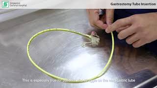 All About Percutaneous Radiologicalguided Gastrostomy Insertion [upl. by Ttegirb365]