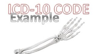 How to Code Correctly with ICD10 [upl. by Ingram]