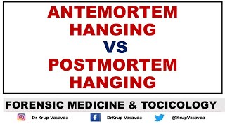 Difference between Antemortem Vs Postmortem hanging Dr Krup Vasavda [upl. by Sherurd]