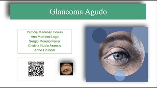 Glaucoma Agudo [upl. by Gebler779]