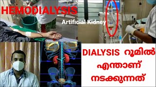 HEMODIALYSIS എങ്ങനെProcedure of dialysis [upl. by Fergus]