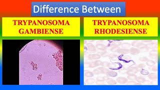 Difference Between Trypanosoma Gambiense and Trypanosoma Rhodesiense [upl. by Yretsym88]