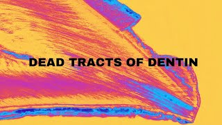 Dead tracts in dentin  Why are they dead  Dentistry Oral Histology 🔬 [upl. by Nylak708]