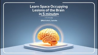 Quick Medical Guide  Space Occupying Lesions of the Brain Medschoolcapsules [upl. by Bergeron]