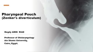 Pharyngeal Pouch  Zenkers diverticulum [upl. by Horgan]