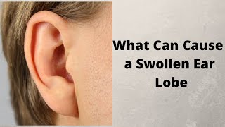 What Can Cause a Swollen Ear Lobe [upl. by Nylra198]