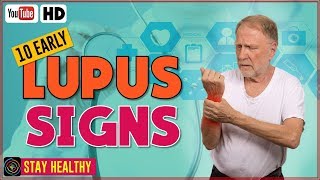 10 Lupus Disease Symptoms and Causes [upl. by Lobell]