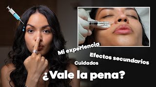 💉Rinomodelacion  ¡nueva nariz SIN CIRUGIA [upl. by Azar]