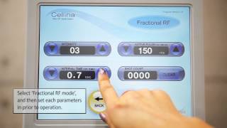 Fractional RF Laser EquipmentBeauty Cellina Skin Treatment Micro needle RF by Dosis MampM [upl. by Zebada]