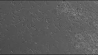 Planktonic Bacteria Swimming Around a BioFilm [upl. by Eloise]