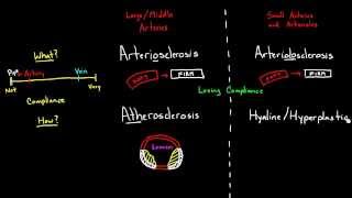 Arteriosclerosis Arteriolosclerosis and Atherosclerosis [upl. by Ethelbert]