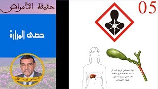 حقيقة حصى المرارة  الدكتور محمد فائد [upl. by Richel704]