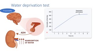 USMLE Step 1 Diabetes Insipidus vs Psychogenic polydipsia water deprivation test [upl. by Rehptsirhc34]