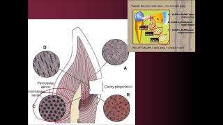 Dentine histology by DrM ALNsour [upl. by Aihsein]