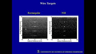 Improving Lateral Resolution In Ultrasonic Imaging By Utilizing Nulls In The Beam Pattern [upl. by Irakuy]