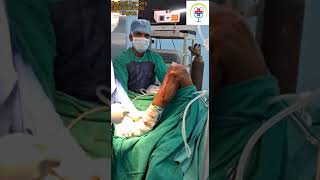 Stiff Knee Treatment at OT  जाम घुटने को OT मे सीधा कर दिया  kneesurgery kneepain kneeinjury [upl. by Aeneg]