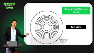 Basic Principles of Multifocal IOLs [upl. by Abell698]