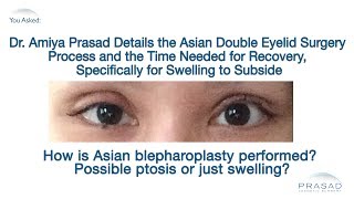 The Asian Double Eyelid Surgery Process and Why Temporary Swelling Occurs [upl. by Hetti]