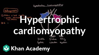 Hypertrophic cardiomyopathy Pathophysiology and diagnosis  NCLEXRN  Khan Academy [upl. by Quiteri]