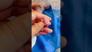 510 grms weight baby hand😱😱newbornbabynewborncareprematurebaby [upl. by Barrie]