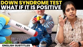 Down Syndrome Test  What If It Is Positive  டவுன் சிண்ட்ரோம் இருப்பதை எப்படி தெரிந்து கொள்வது [upl. by Aliek]