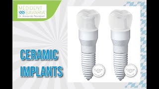 Ceramic Implants [upl. by Stephani9]