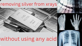 REMOVING SILVER FROM XRAYS WITHOUT USING ANY ACID [upl. by Llirret]