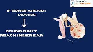 WHAT IS OTOSCLEROSIS [upl. by Ylrak]